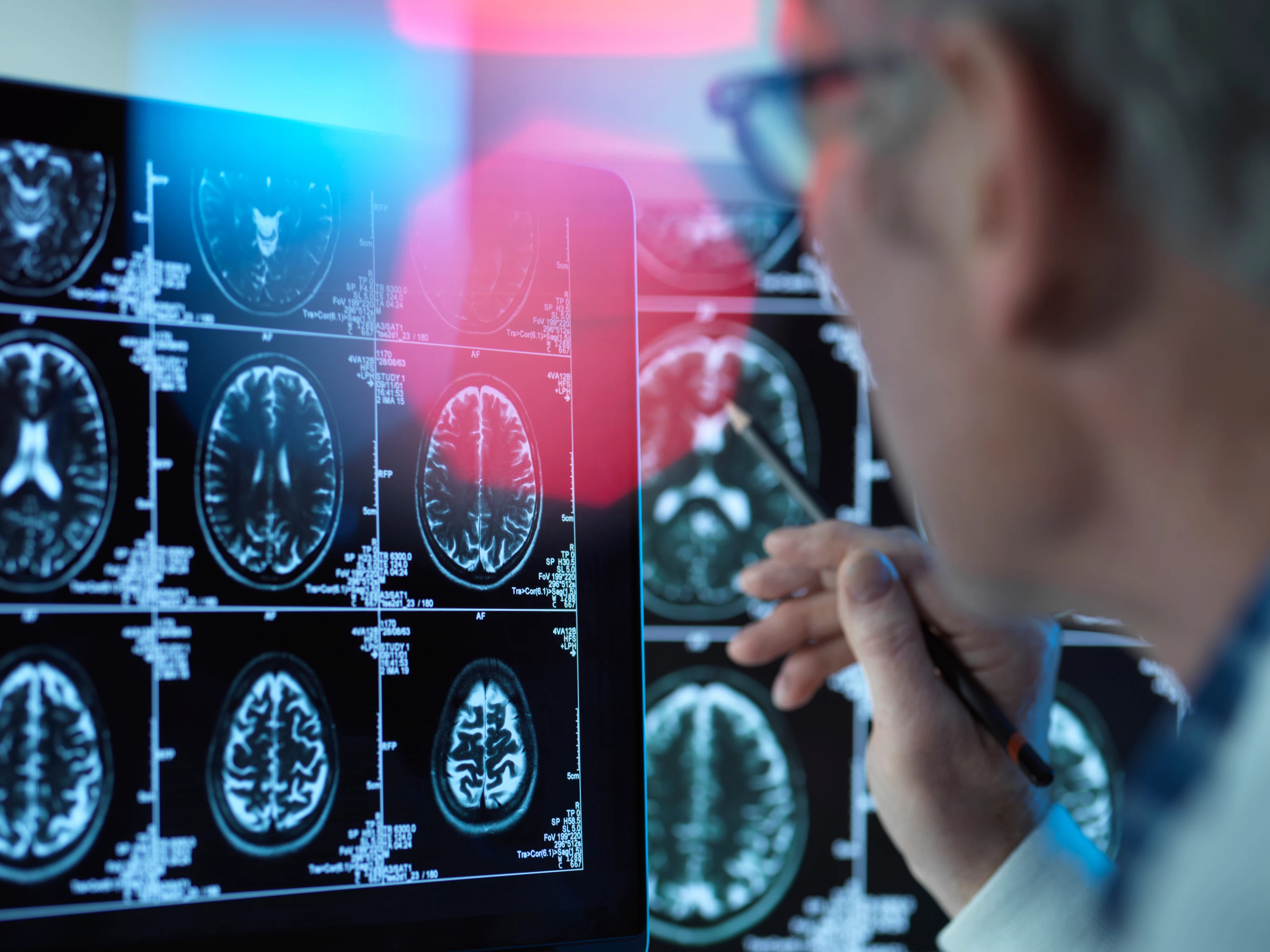 A clinician reviewing a wall of brain imaging scans.